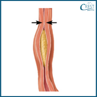 digestive-system4-q4b